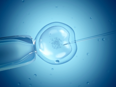 IVF procedure 